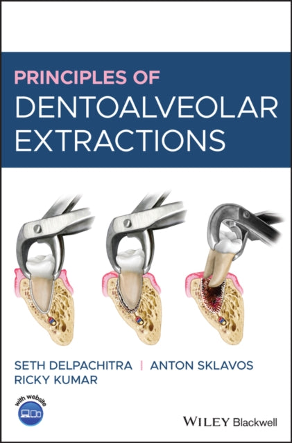 Book cover of: Principles of Dentoalveolar Extractions. By: Seth Delpachitra