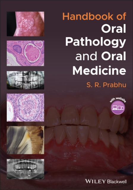 Book cover of: Handbook of Oral Pathology and Oral Medicine. By: S. R. Prabhu