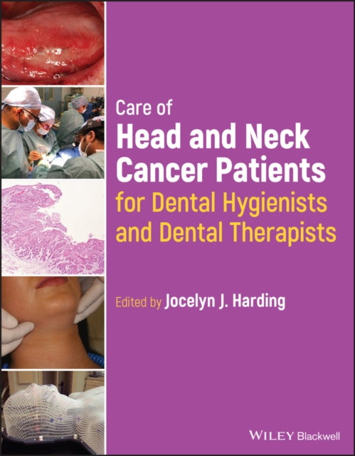 Book cover of: Care of Head and Neck Cancer Patients for Dental Hygienists and Dental Therapists. By: Jocelyn J. Harding