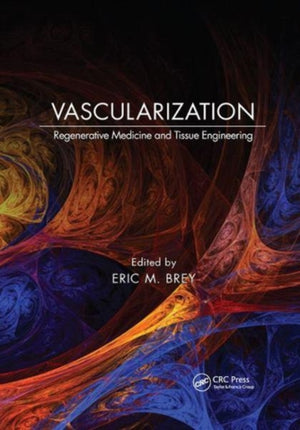 Vascularization