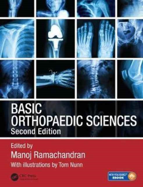Book cover of: Basic Orthopaedic Sciences. By: Manoj Ramachandran