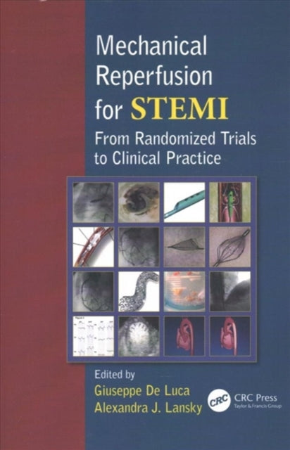 Book cover of: Mechanical Reperfusion for STEMI. By: Giuseppe De Luca