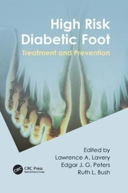 Book cover of: High Risk Diabetic Foot. By: Lawrence A. Lavery