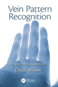 Vein Pattern Recognition
