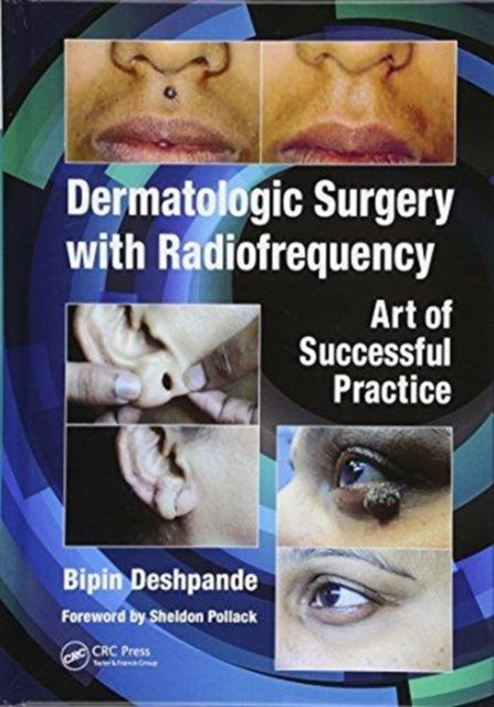 Book cover of: Dermatologic Surgery with Radiofrequency. By: Bipin Deshpande