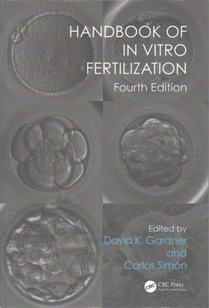Handbook of In Vitro Fertilization
