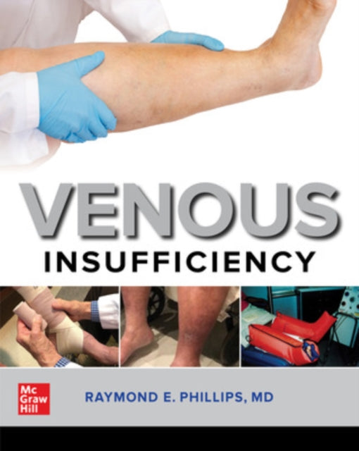 Book cover of: Venous Insufficiency. By: Raymond E. Phillips