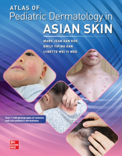 Book cover of: Atlas of Pediatric Dermatology in Asian Skin. By: Mark Jean Aan Koh