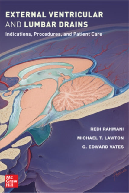 Book cover of: External Ventricular and Lumbar Drains: Indications, Procedures, and Patient Care. By: Redi Rahmani