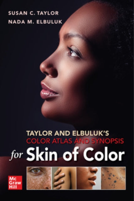 Book cover of: Taylor and Elbuluk's Color Atlas and Synopsis for Skin of Color. By: Susan C. Taylor