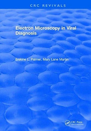 Electron Microscopy in Viral Diagnosis