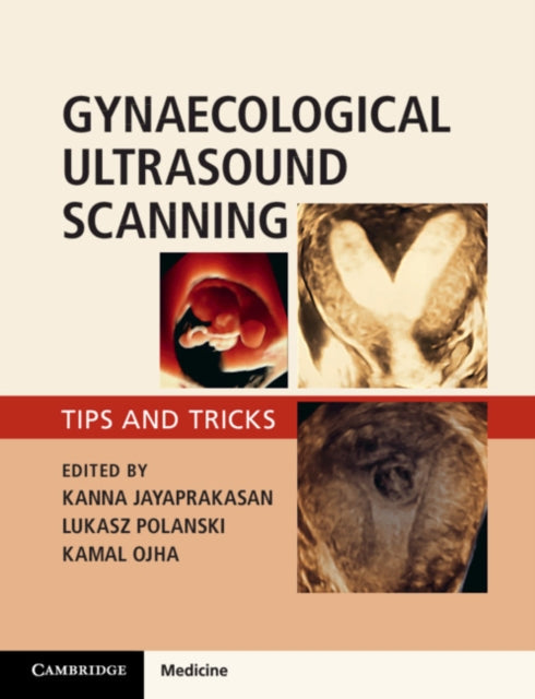 Book cover of: Gynaecological Ultrasound Scanning. By: Kanna Jayaprakasan