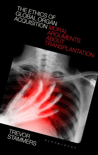 Book cover of: Ethics of Global Organ Acquisition. By: Trevor Stammers