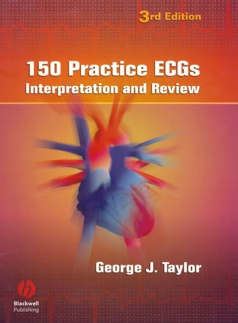 Book cover of: 150 Practice ECGs. By: George Jesse Taylor