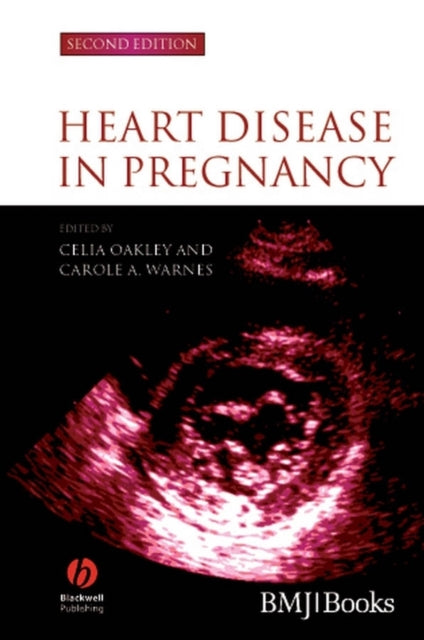 Book cover of: Heart Disease in Pregnancy. By: Carole A. Warnes