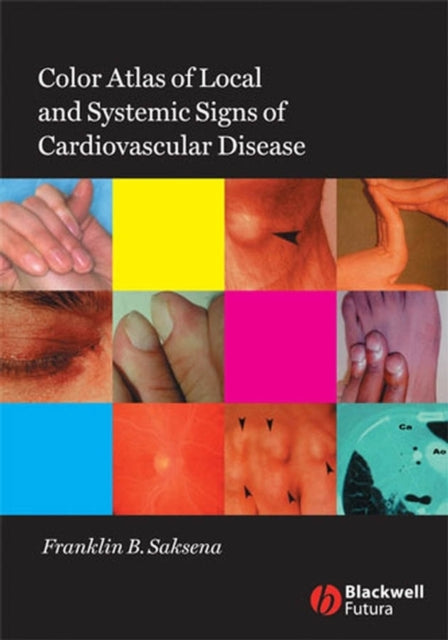 Book cover of: Color Atlas of Local and Systemic Manifestations of Cardiovascular Disease. By: Franklin B. Saksena