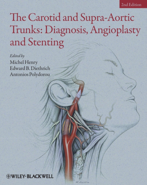 Book cover of: Carotid and Supra-Aortic Trunks. By: Michel Henry