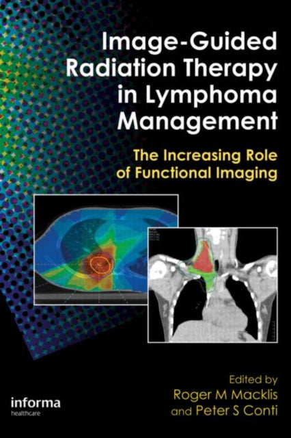 Book cover of: Image-Guided Radiation Therapy in Lymphoma Management