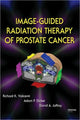 Book cover of: Image-Guided Radiation Therapy of Prostate Cancer