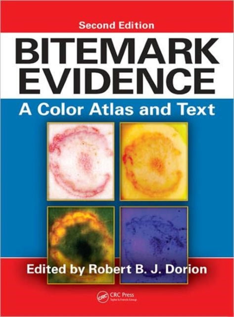 Book cover of: Bitemark Evidence. By: Robert B. J. Dorion