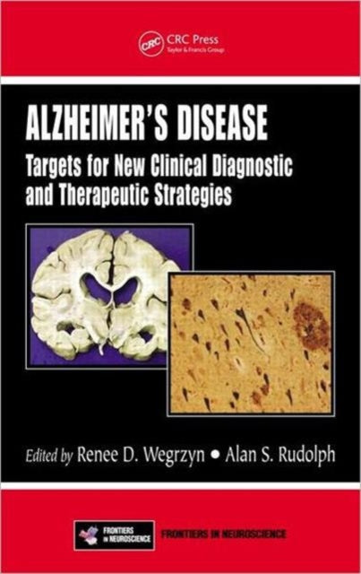 Book cover of: Alzheimer's Disease. By: Alan S. Rudolph