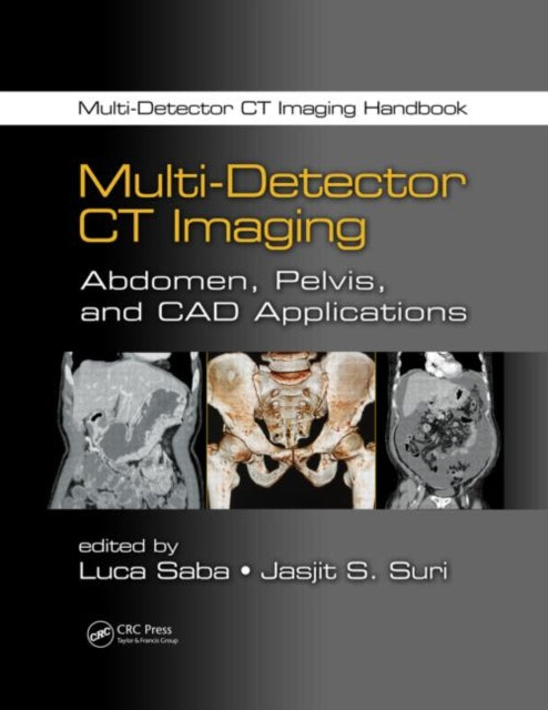 Book cover of: Multi-Detector CT Imaging. By: Luca Saba