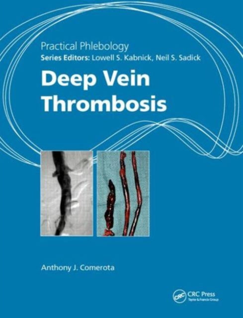 Book cover of: Practical Phlebology. By: Anthony J. Comerota