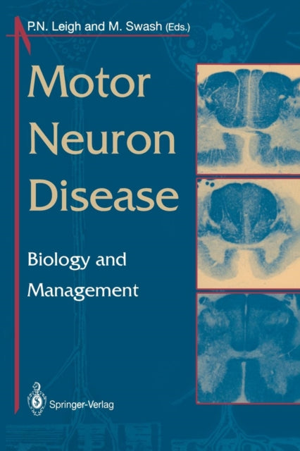 Book cover of: Motor Neuron Disease. By: P.N. Leigh