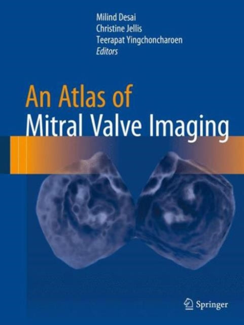 Book cover of: Atlas of Mitral Valve Imaging. By: Milind Desai