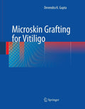 Microskin Grafting for Vitiligo