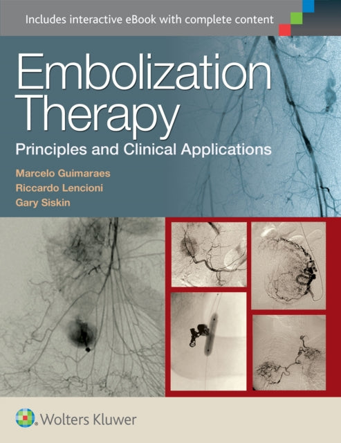 Book cover of: Embolization Therapy: Principles and Clinical Applications