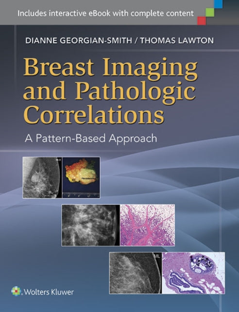 Book cover of: Breast Imaging and Pathologic Correlations. By: Dianne Georgian-Smith