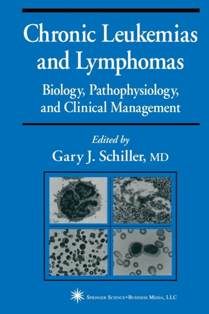Book cover of: Chronic Leukemias and Lymphomas. By: Gary J. Schiller