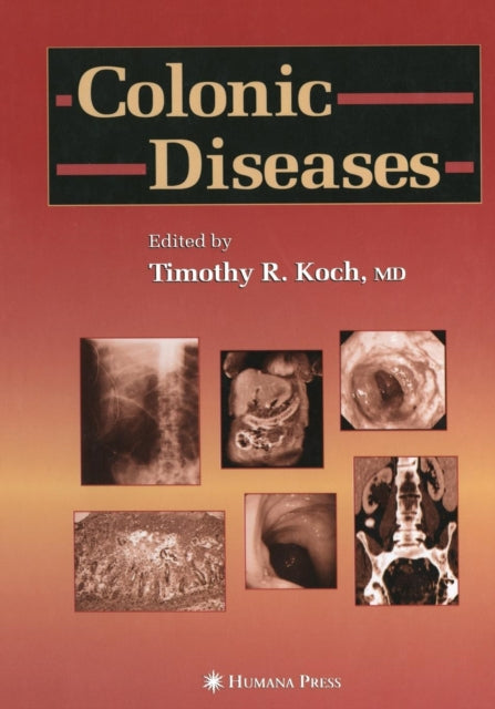 Book cover of: Colonic Diseases. By: Timothy R. Koch