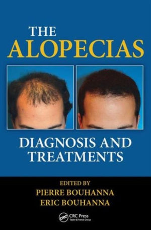 The Alopecias
