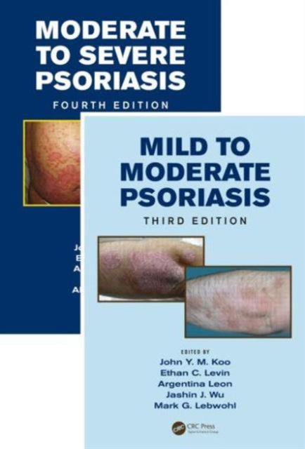Book cover of: Mild to Moderate and Moderate to Severe Psoriasis (Set). By: John Y. M. Koo