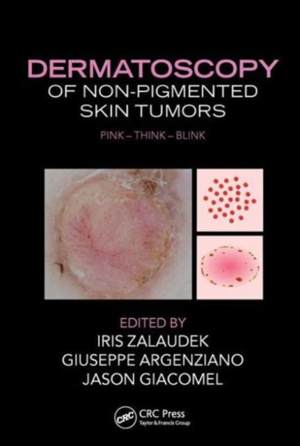 Book cover of: Dermatoscopy of Non-Pigmented Skin Tumors. By: Iris Zalaudek