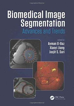 Biomedical Image Segmentation
