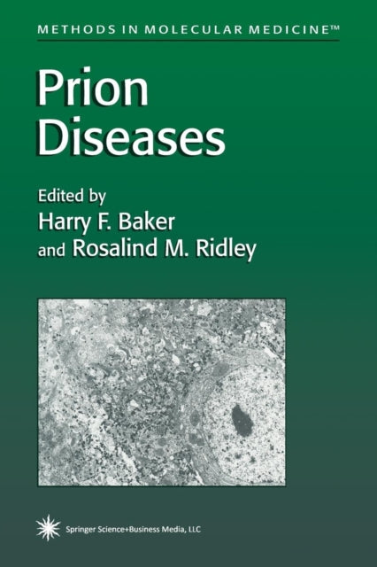 Book cover of: Prion Diseases. By: Harry F. Baker