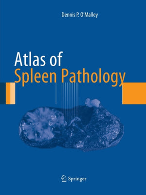 Atlas of Spleen Pathology
