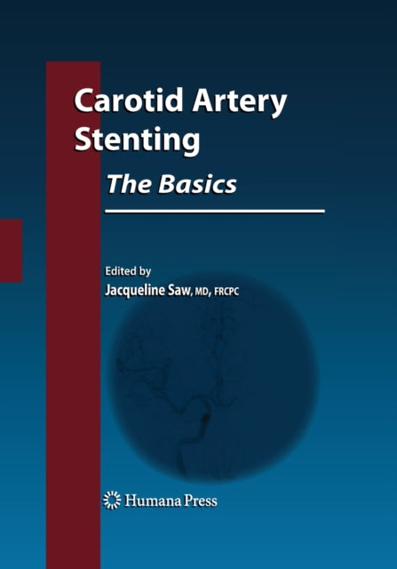 Book cover of: Carotid Artery Stenting: The Basics. By: Jacqueline Saw