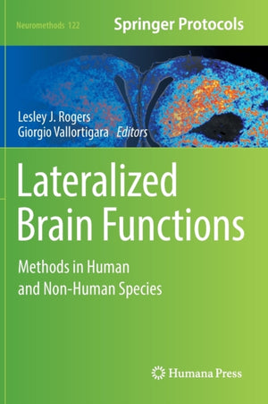 Lateralized Brain Functions