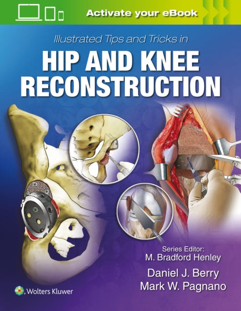 Book cover of: Illustrated Tips and Tricks in Hip and Knee Reconstructive and Replacement Surgery. By: Daniel J. Berry MD