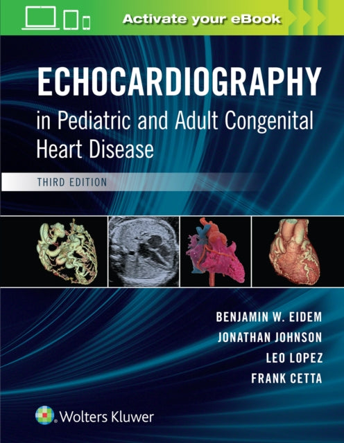 Book cover of: Echocardiography in Pediatric and Adult Congenital Heart Disease. By: Benjamin W. Eidem MD  FACC  FASE