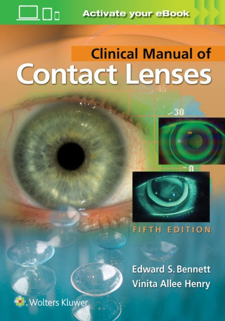 Book cover of: Clinical Manual of Contact Lenses. By: Vinita Allee Henry