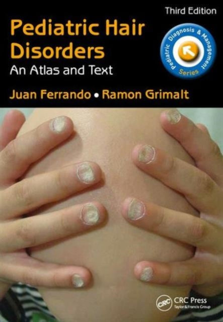 Book cover of: Pediatric Hair Disorders. By: Juan Ferrando