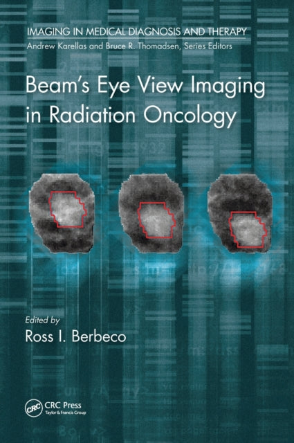 Book cover of: Beam's Eye View Imaging in Radiation Oncology. By: Ross I. Berbeco