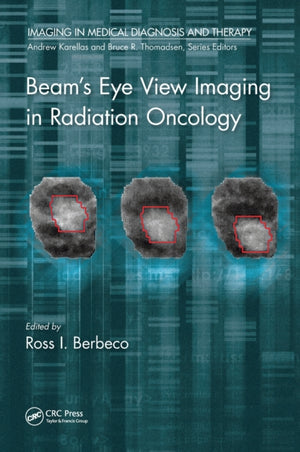 Beam's Eye View Imaging in Radiation Oncology
