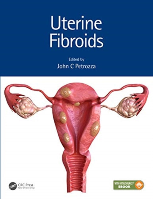 Book cover of: Uterine Fibroids. By: John C. Petrozza