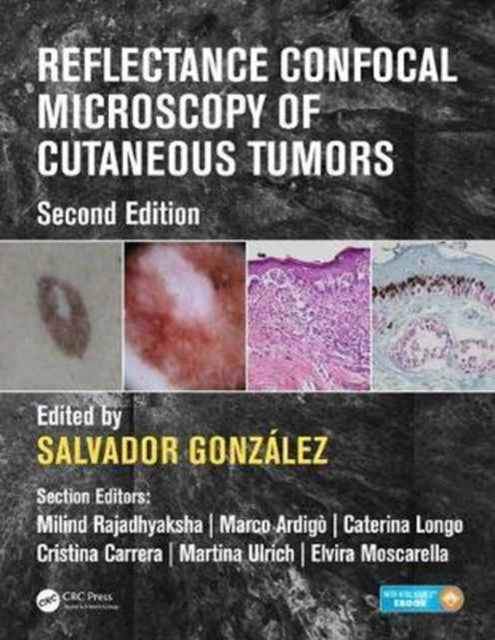 Book cover of: Reflectance Confocal Microscopy of Cutaneous Tumors. By: Salvador Gonzalez